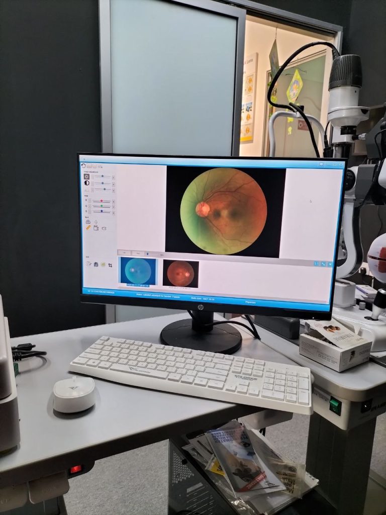 eye screening